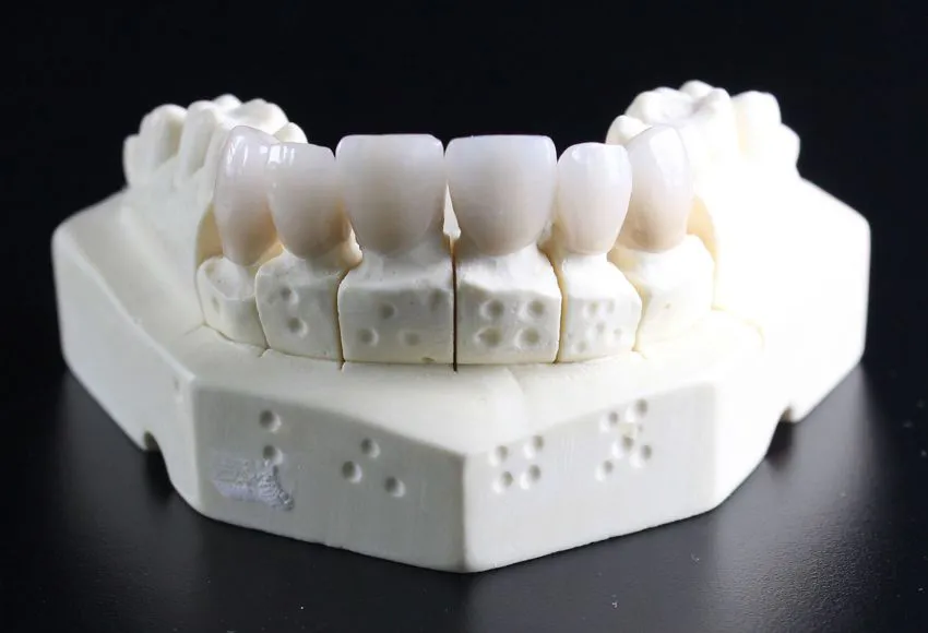 Chirurgia Implantare e Rigenerativa