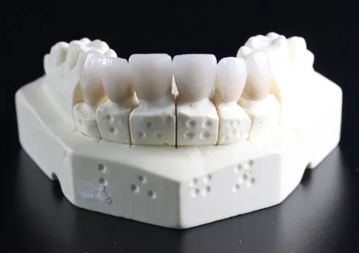 Chirurgia Implantare e Rigenerativa