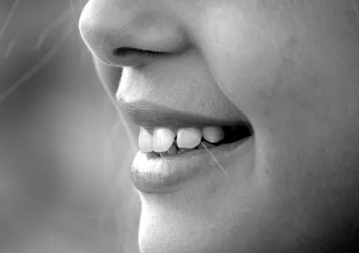Estetica dentale
