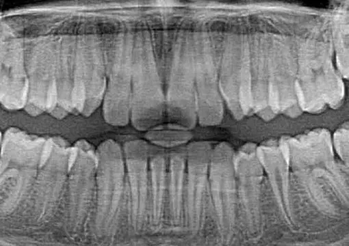 Endodonzia